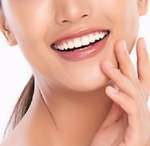 Aneesha khan Botox for Gummy Smile in Dubai