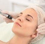 Microneedling Treatment